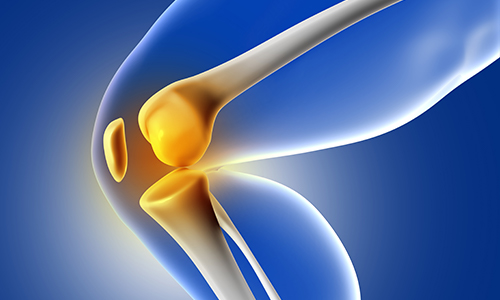 Knee Replacement